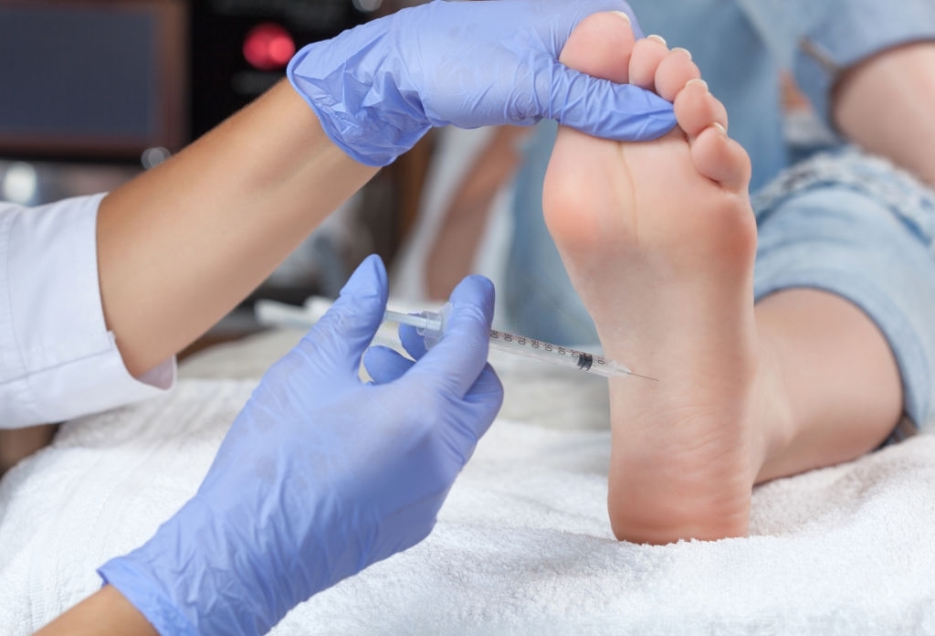 Queens, NY Podiatrist Injecting Into Foot