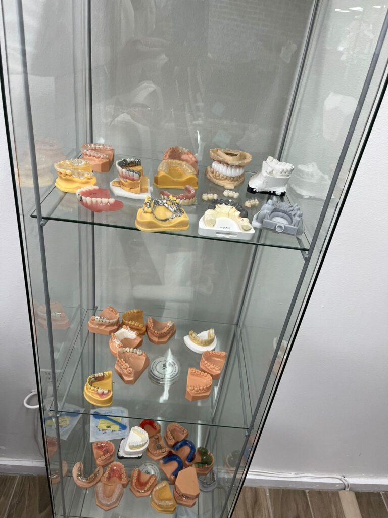 Dentures After Repair In Queens, NY